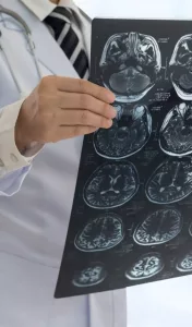 doctor holding brain scan
